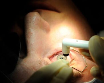 lasik2