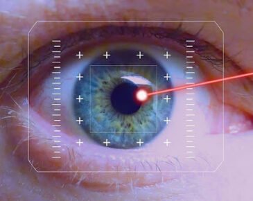 lasik3